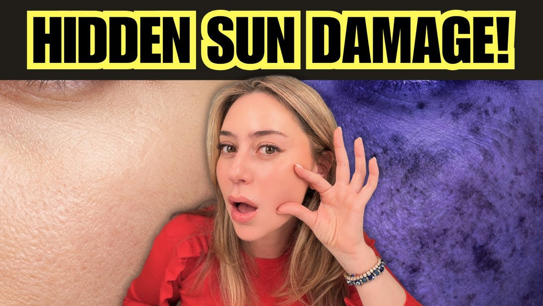A dermatologist's guide to treating hidden sun damage and post-inflammatory hyperpigmentation with Dreamey CloudThera bedding.