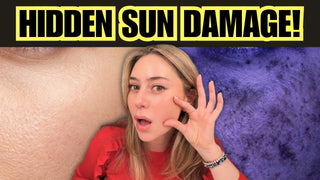 A dermatologist's guide to treating hidden sun damage and post-inflammatory hyperpigmentation with Dreamey CloudThera bedding.